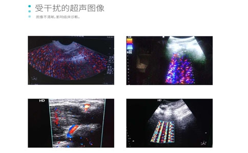 彩超用抗干擾系統(tǒng)